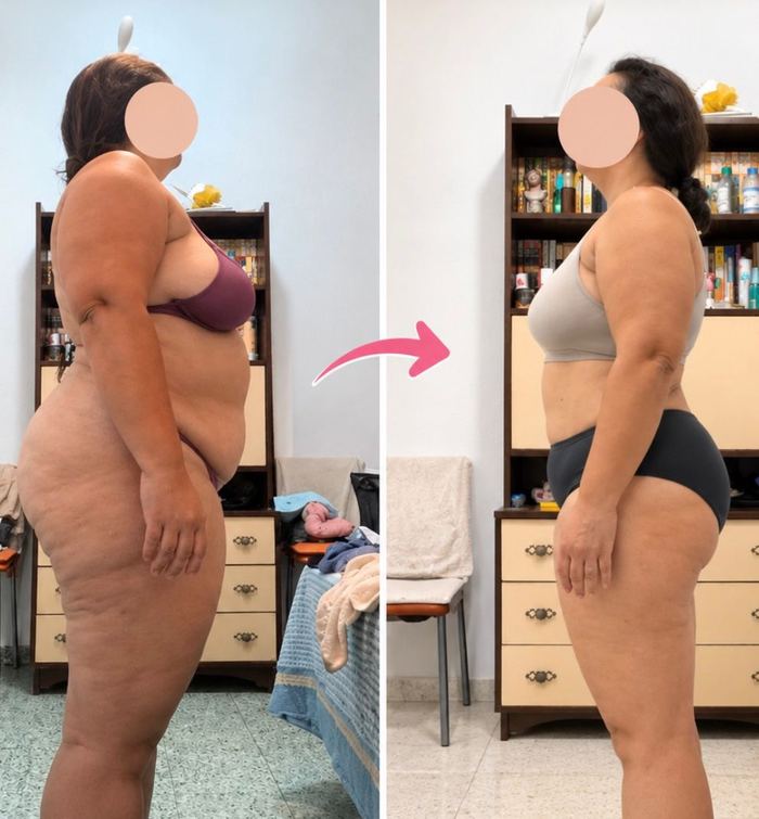 Antes y después de una alumna